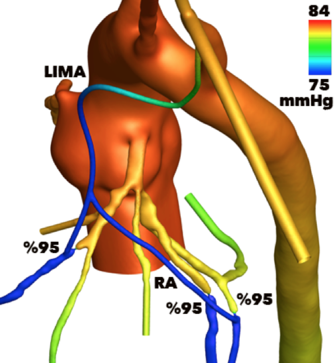 Computational cardiovascular flow visualization