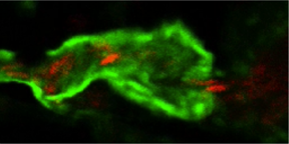 Imaging of vessels and blood cells in zebrafish embryos