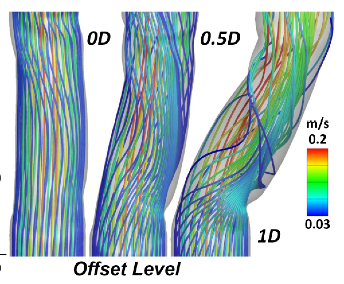 Patient-specific cardiovascular surgical planning models