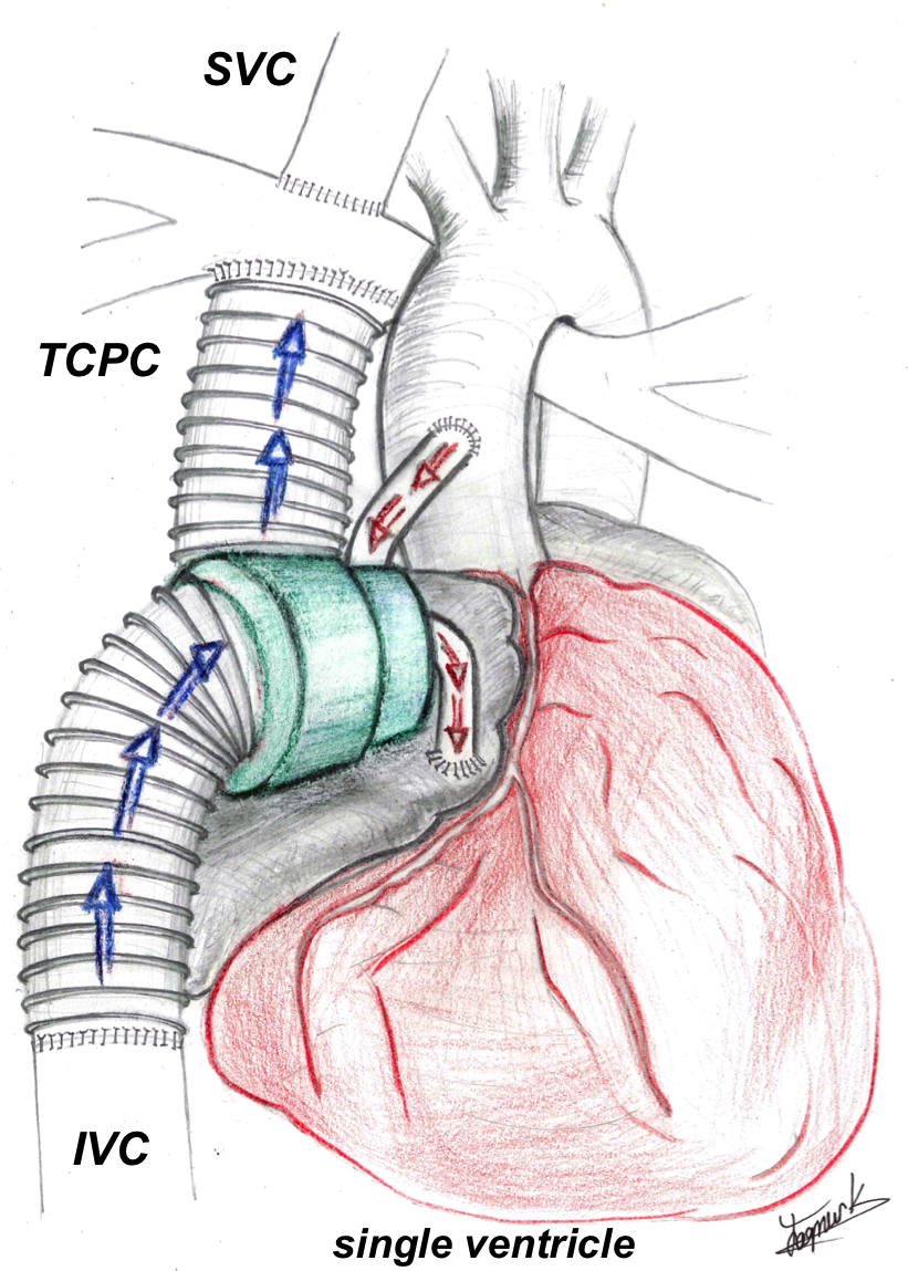 Cardiovascular assist device research